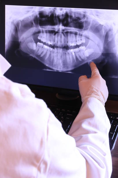 Best Chipped Tooth Repair Near Me  in Kingsland, TX
